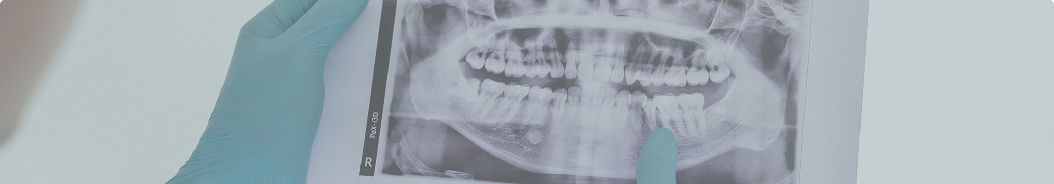 Dentist looking at an x-ray of a patient's teeth