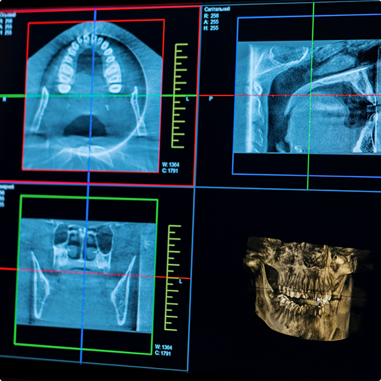 Computer screen showing x-rays of a patient's teeth and jaws