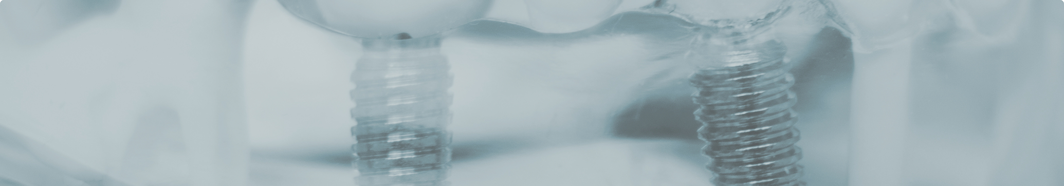 Model of the mouth with two dental implants in Tewksbury