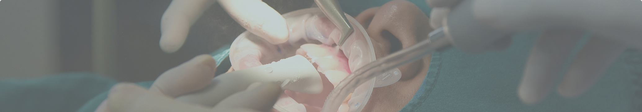 Patient receiving treatment from an emergency dentist in Tewksbury