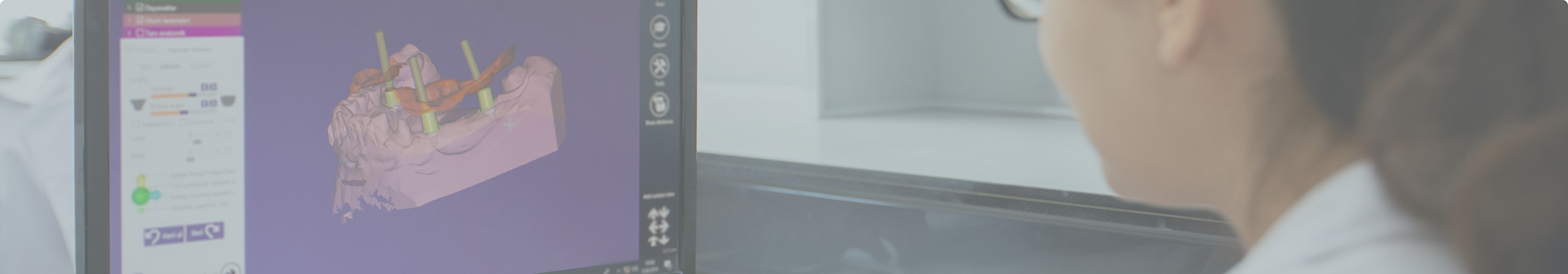 Dentist taking digital impressions of a patient's teeth
